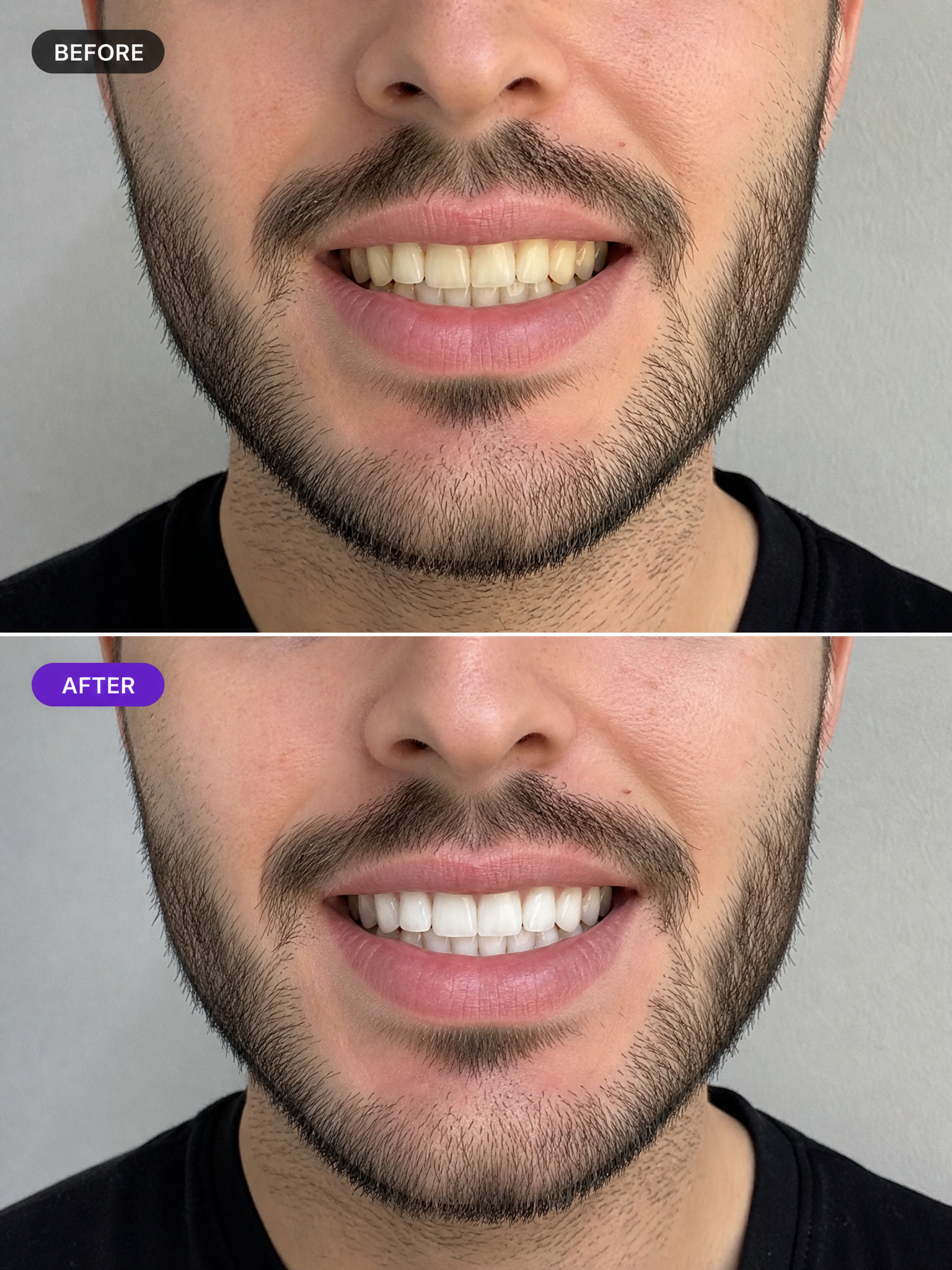 Before and after